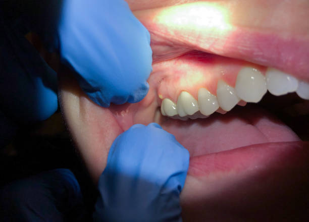 Best Emergency TMJ Treatment in Lookout Mountain, GA