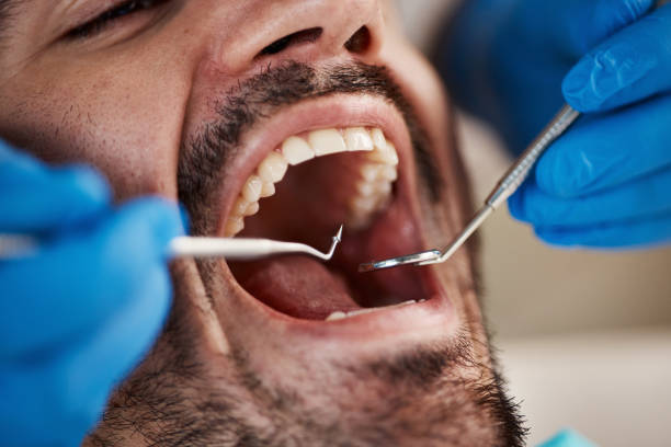 Best Emergency Tooth Extraction in Lookout Mountain, GA